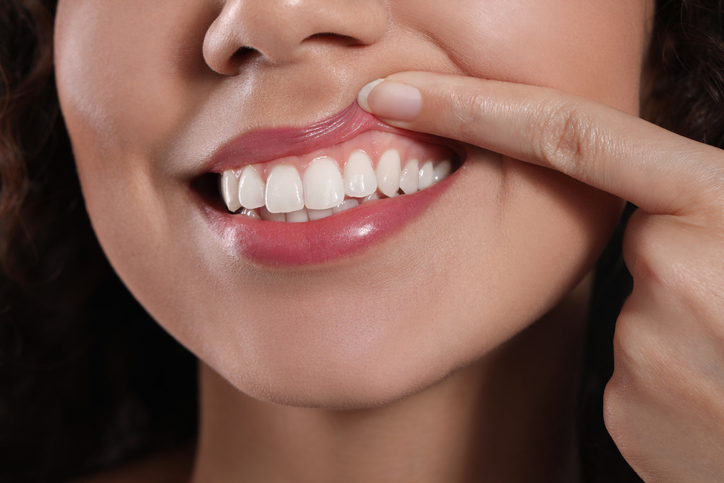 Smiling woman lifting her upper lip with her index finger to show her gums